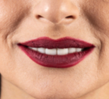 כתרים דיגיטליים מזרקוניה: כל היתרונות-תמונה